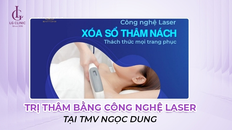 Trị thâm bằng Laser tại TMV Ngọc Dung