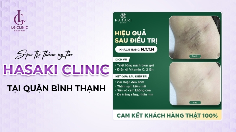 Kết quả liệu trình trị thâm nách tại Hasaki Clinic & Spa
