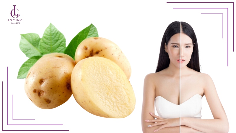 Tắm trắng bằng khoai tây giúp da trắng mịn