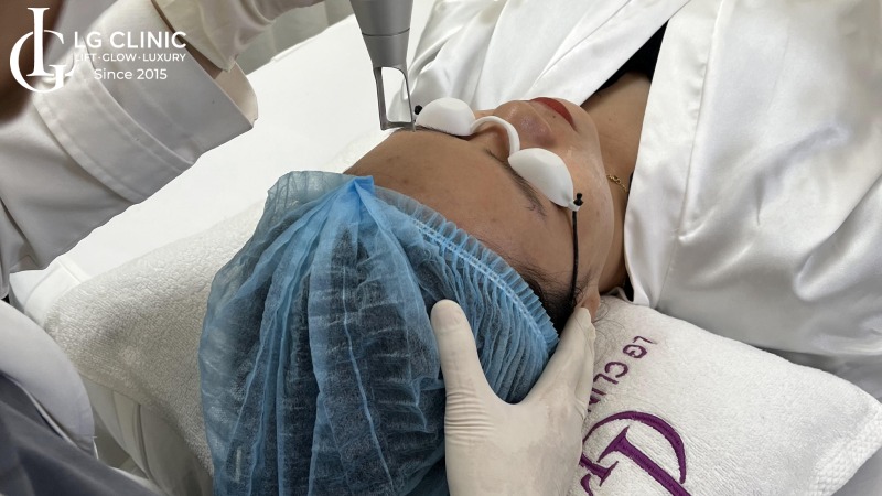 trị thâm mụn với mật ong