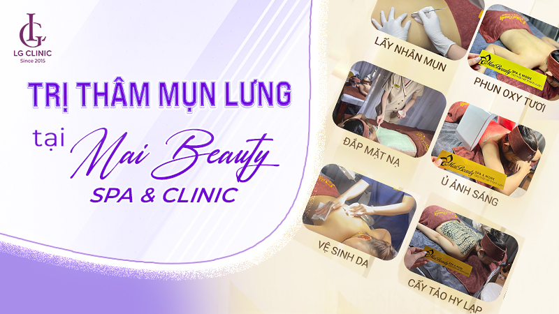 Liệu trình trị thâm mụn lưng tại Mai Beauty Spa & Clinic