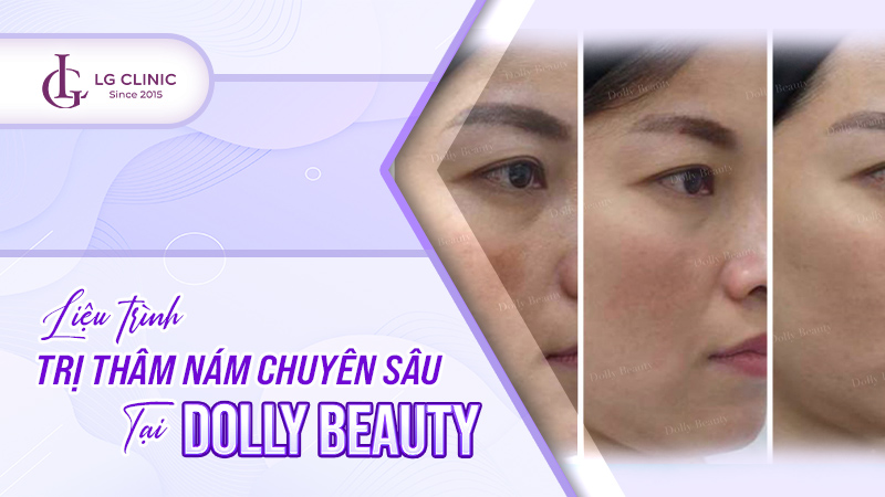 Trị thâm Dolly Beauty