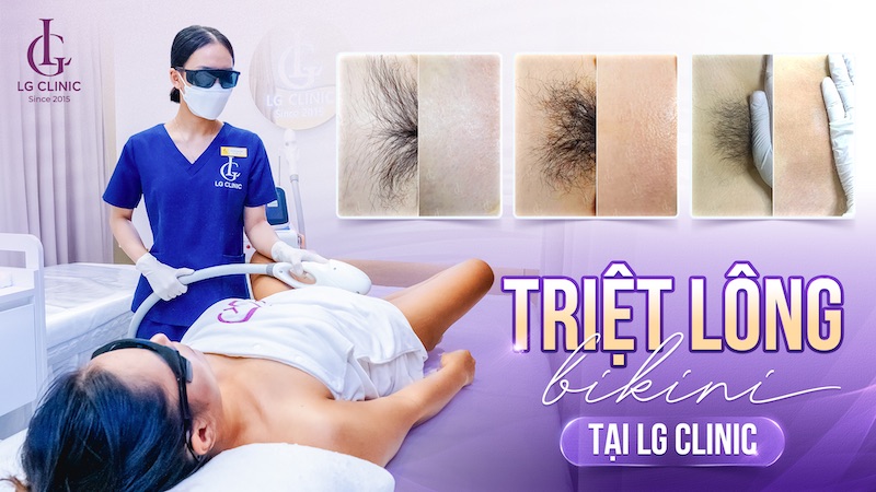 spa triệt bikini
