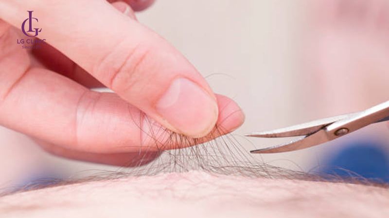 cách cắt tỉa lông vùng kín nam bằng kéo