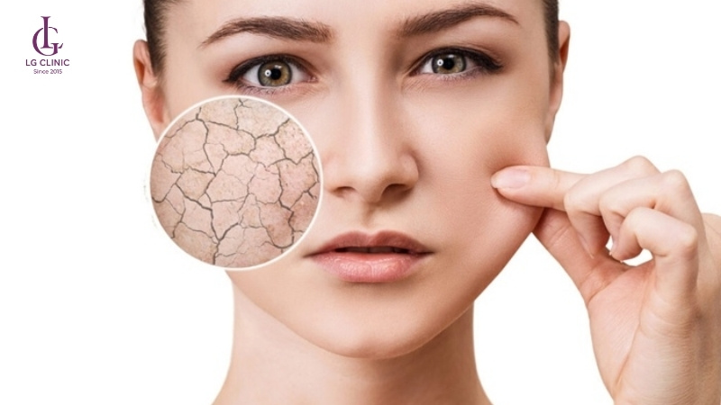 Không tẩy tế bào chết có thể gây tắc lỗ chân lông và lông mọc ngược