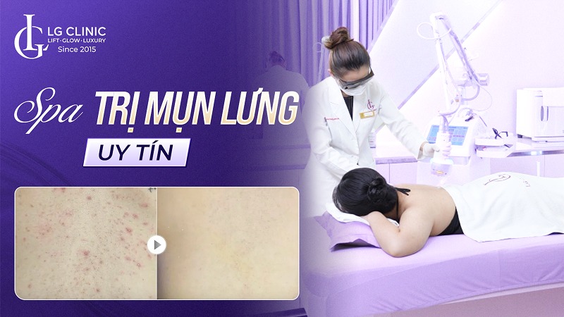 spa trị mụn lưng