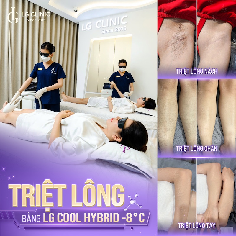 Công nghệ triệt lông LG Cool Hybrid độc quyền tại Little Garden Spa