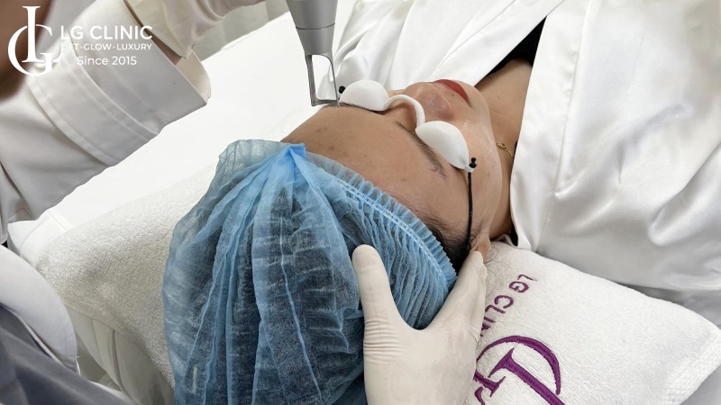 trị thâm mụn bằng gừng