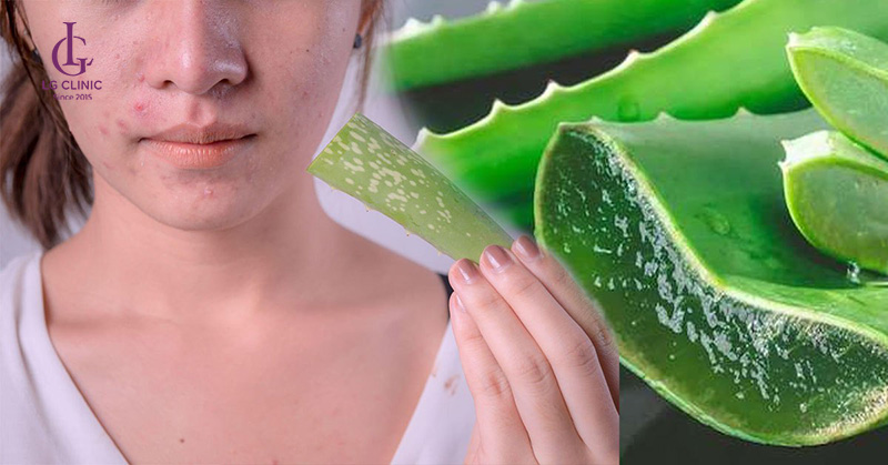 cách trị mụn thâm bằng nha đam