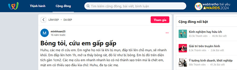 Trị thâm mụn bằng tỏi