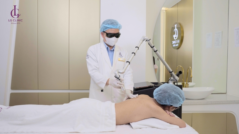 Trị thâm mụn lưng bằng laser tại LG Clinic