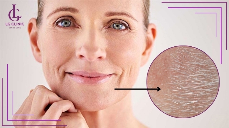 Những trường hợp không nên triệt lông OPT SHR để đảm bảo an toàn
