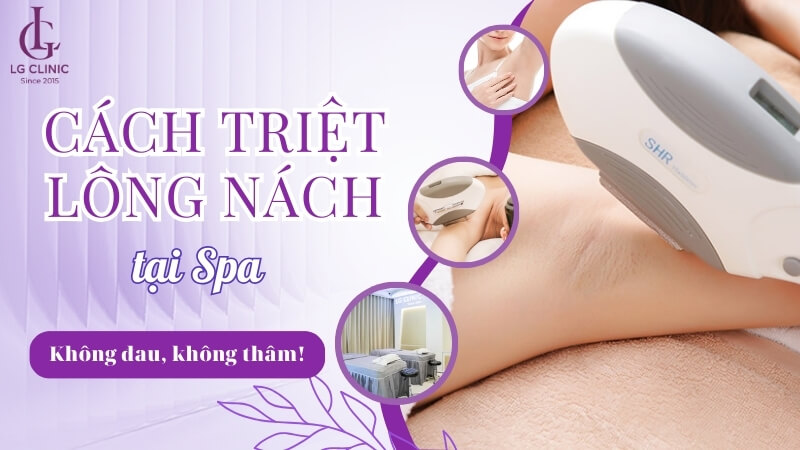 cách triệt lông nách tại spa