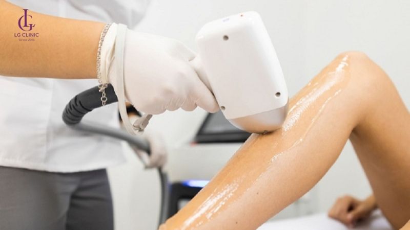 giá triệt lông diodelaser sẽ khác nhau tùy vào cơ sở thẩm mỹ