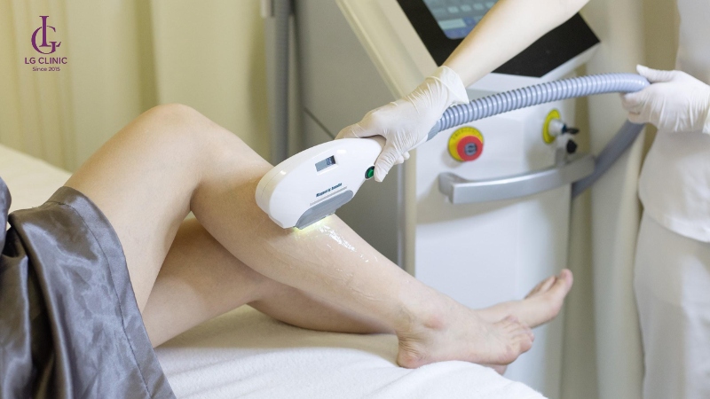 Công nghệ triệt lông OPT SHR giúp loại bỏ lông hiệu quả và an toàn