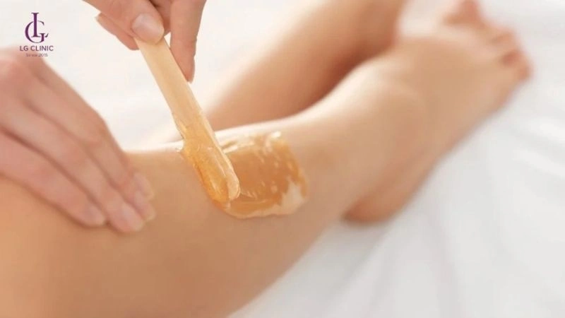 Ai không nên triệt lông IPL? Lưu ý quan trọng trước khi điều trị