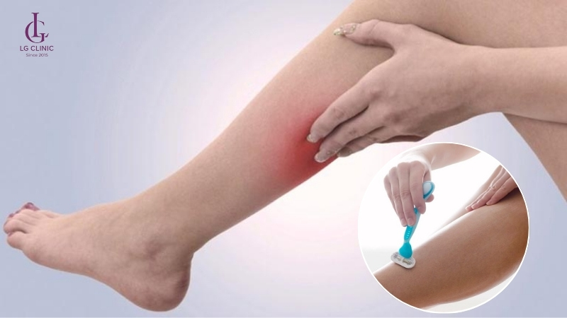cạo lông không đúng làm cho ngứa sau triệt lông