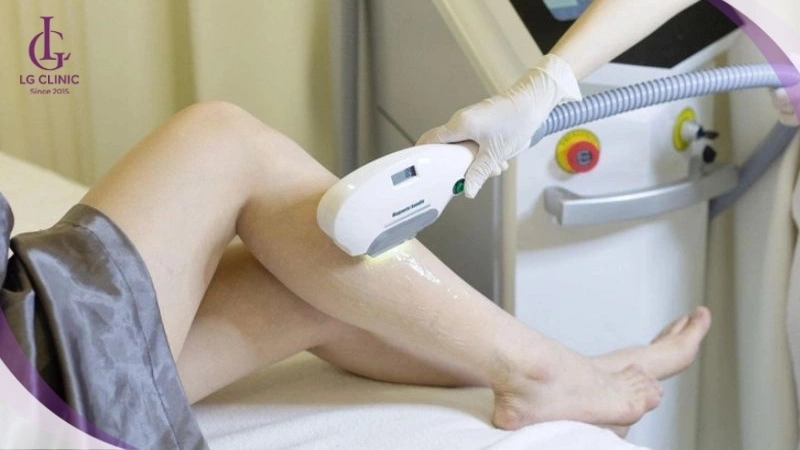 Lưu ý quan trọng khi triệt lông IPL để đảm bảo hiệu quả cao và an toàn cho da.