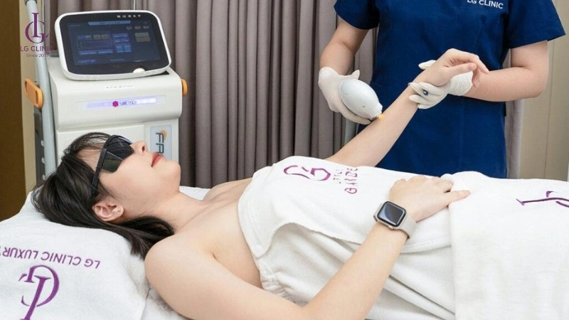 những sai lầm phổ biến khi triệt lông