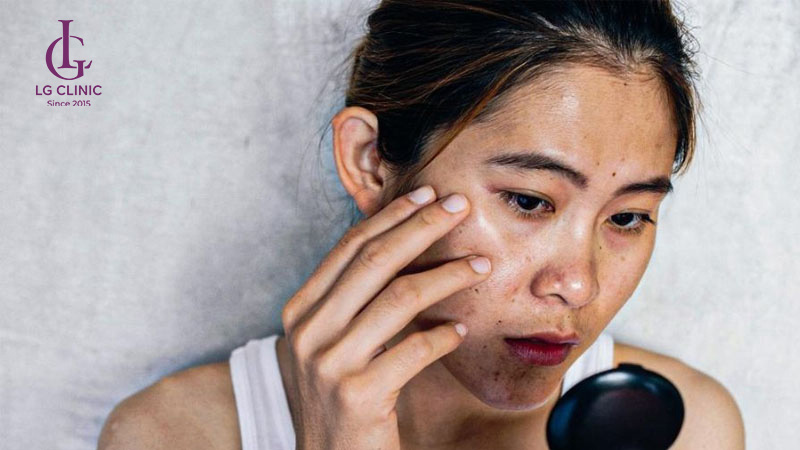làm trắng da toàn thân sau sinh