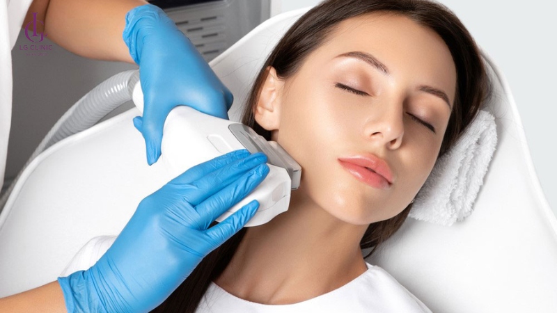 số buổi cần triệt lông mặt