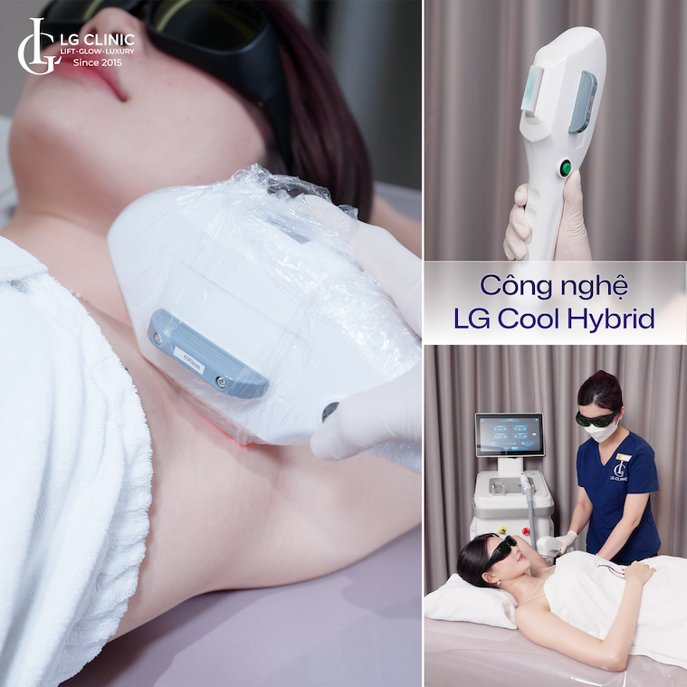 triệt lông diode laser có giá bao nhiêu 