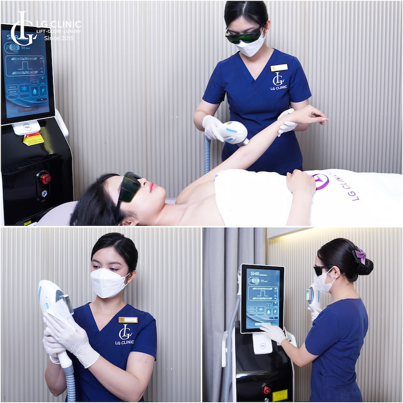 triệt lông xong bị ngứa