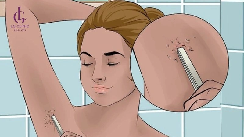 Quy trình triệt lông nách tại Spa