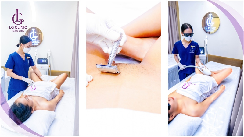 cách loại bỏ lông vùng kín mọc lại