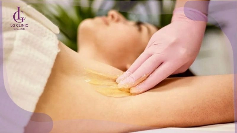 cách triệt lông nách tại nhà