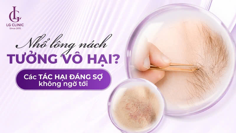 có nên nhổ lông nách không
