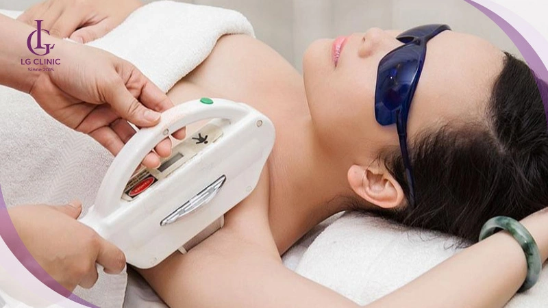 công nghệ triệt lông Elight