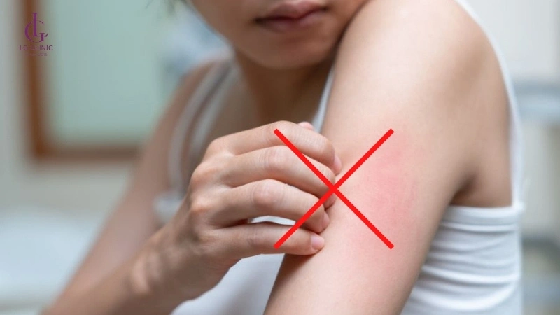 không gãi vào vùng da đang bị ngứa