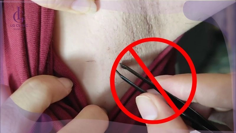Những lưu ý sau khi triệt lông nách