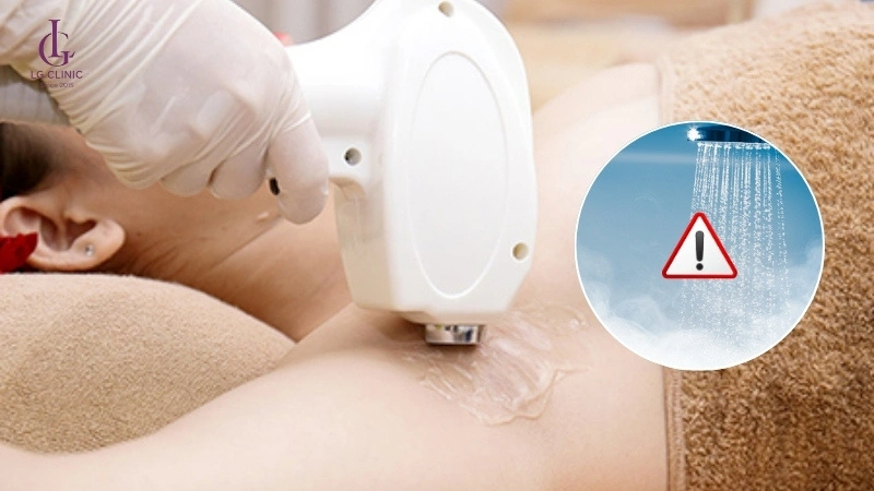 Quy trình triệt lông nách tại Spa