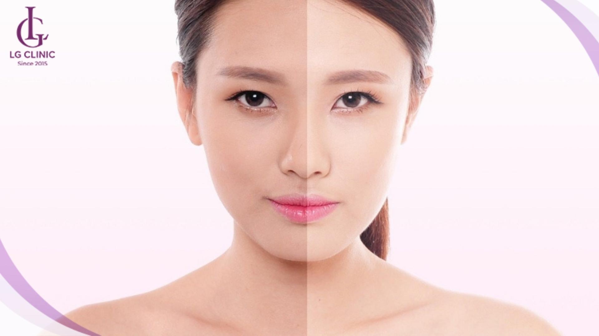 cách làm trắng da mặt nhanh nhất trong 1 tuần