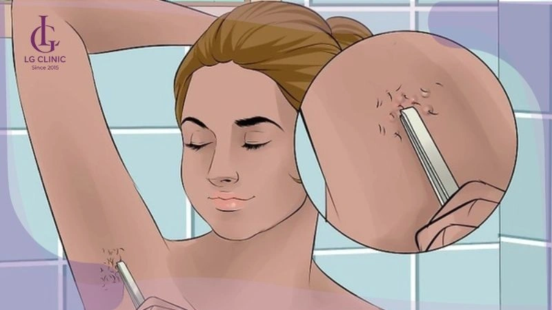 cách nhổ lông nách không đau