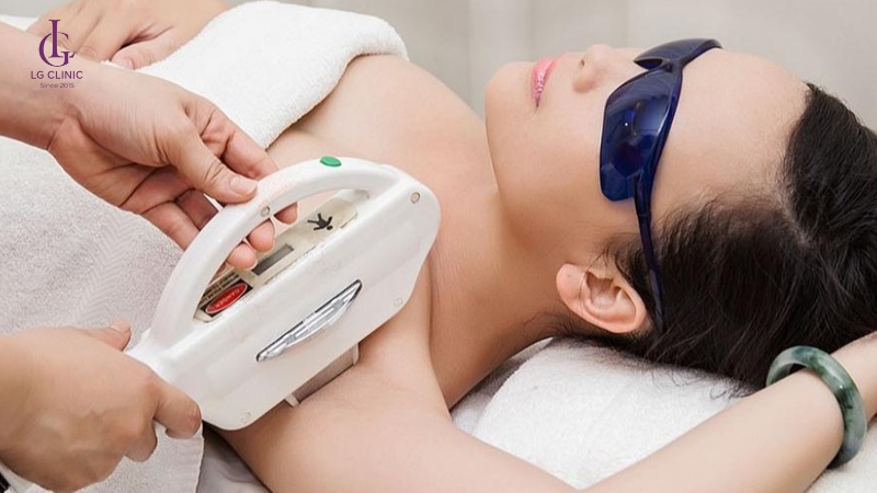 Công nghệ triệt lông New Elight sử dụng ánh sáng IPL kết hợp sóng RF.