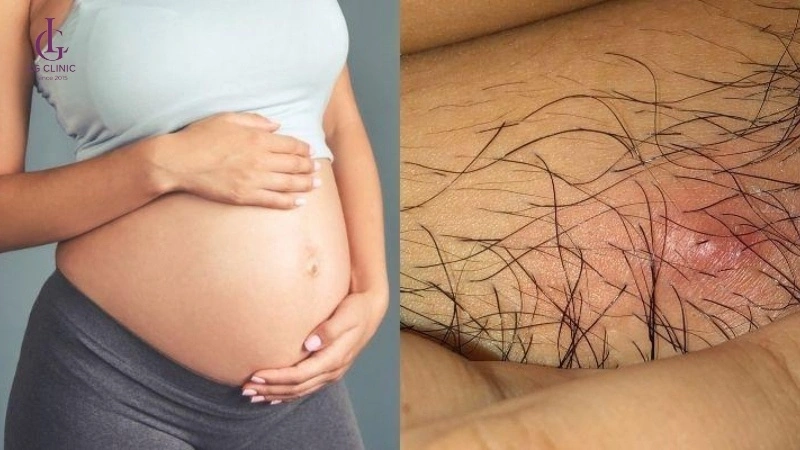 nên cạo lông vùng kín trước khi sinh đẻ