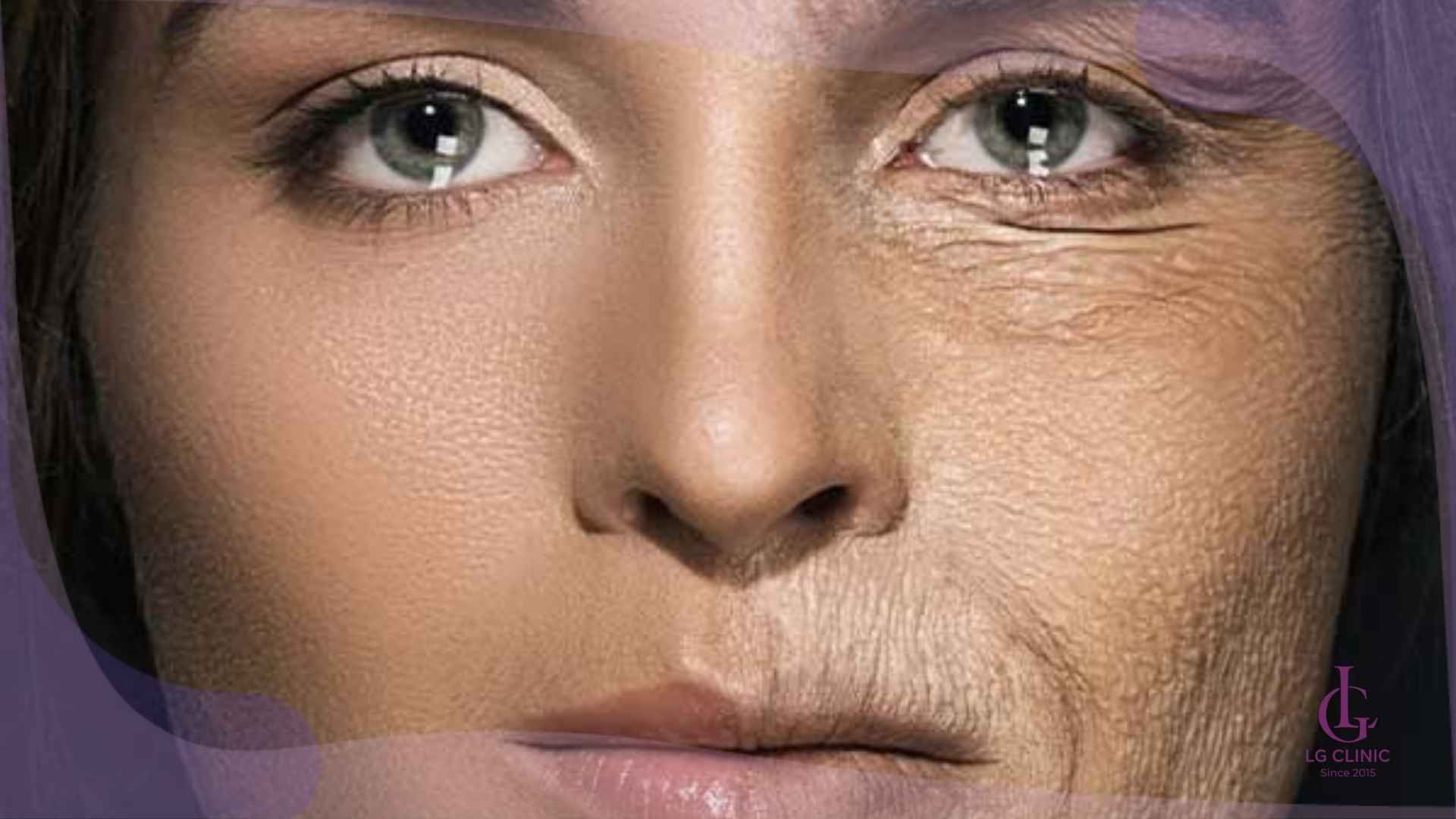 Uống collagen có trắng da không – Collagen giúp da mịn màng, phục hồi từ bên trong.