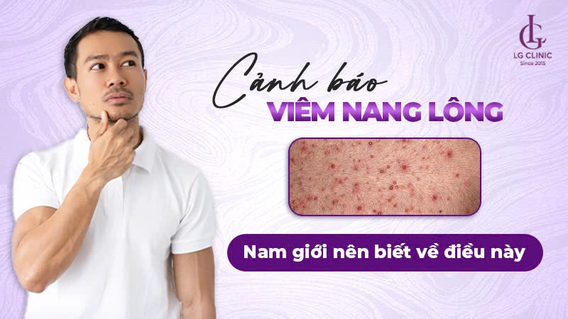 viêm nang lông vùng kín ở nam giới