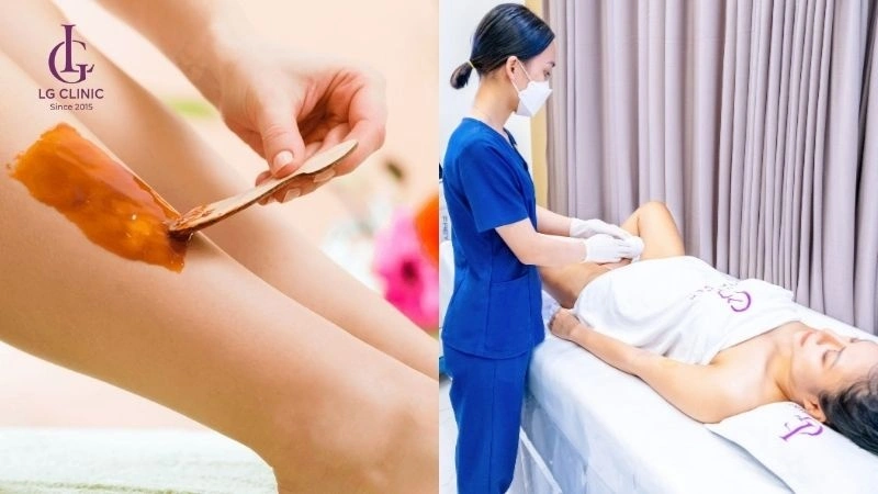 wax hay triệt lông phù hợp với vùng da
