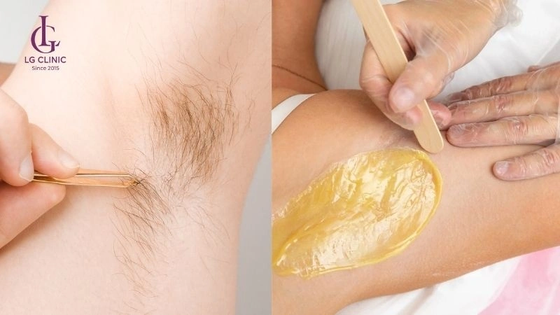 da nách bị sần sùi sau khi nhổ lông
