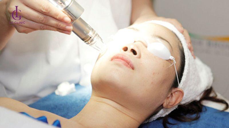 trị thâm nặng bằng laser