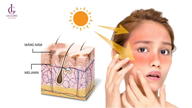 Sắc tố Melanin