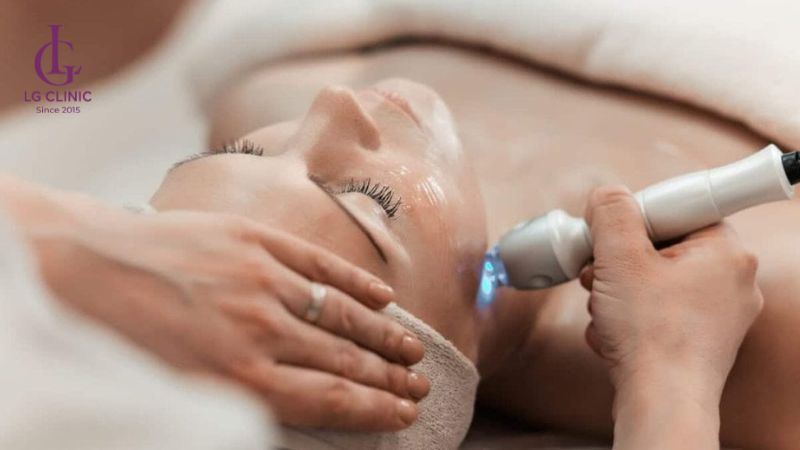 Laser điều trị sắc tố da