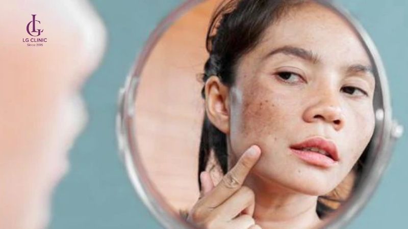 Tăng sắc tố da tạo ra bởi nhiều nguyên nhân khác nhau