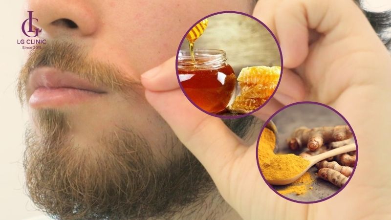 tẩy ria mép cho nam bằng hỗn hợp mật ong và nghệ