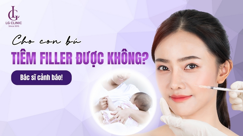cho con bú tiêm filler được không