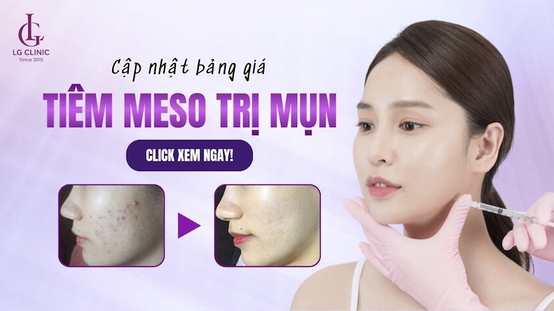 bảng giá tiêm meso trị mụn